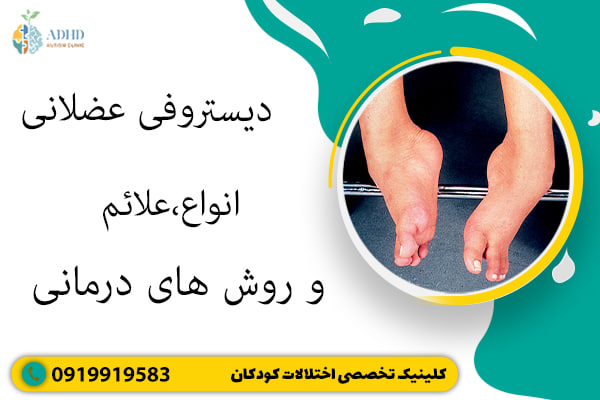 دیستروفی عضلانی:انواع،علائم و روش های درمانی